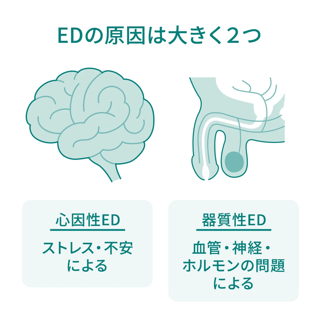EDの原因は大きく2つ:心(脳)が原因の心因性ED(ストレス・不安)、体(血管・神経)が原因の器質性ED(血管・神経・ホルモンの問題)